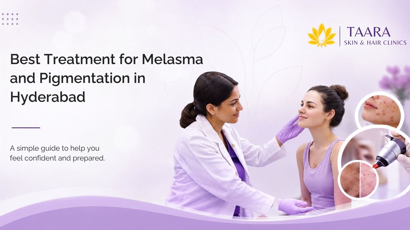 Best Treatment for Melasma and Pigmentation in Hyderabad