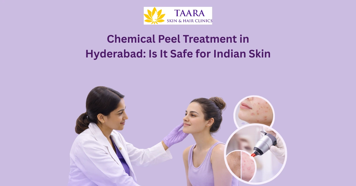 Chemical Peel Treatment in Hyderabad: Is It Safe for Indian Skin