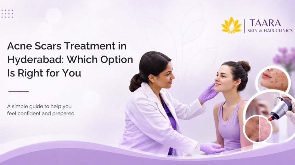 Acne Scars Treatment in Hyderabad: Which Option Is Right for You